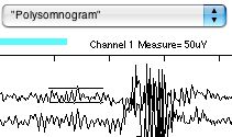 Amplitude cursor
