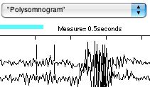 Time cursor