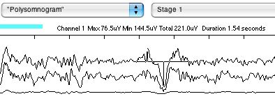 Transients cursor