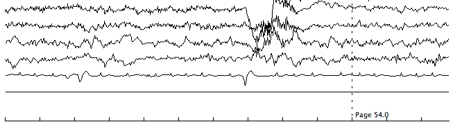 EEG record 1