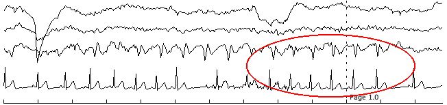 EEG record 3
